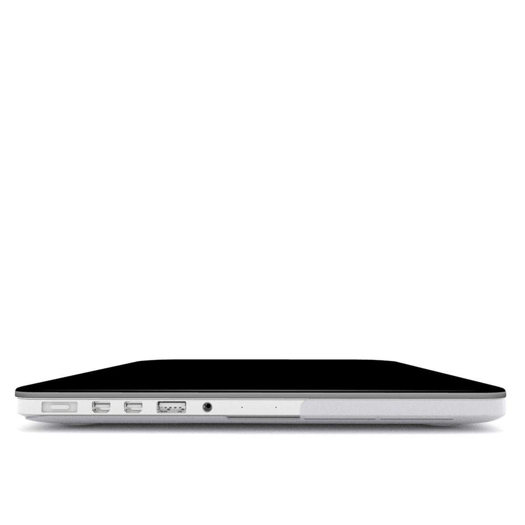 Black MacBook Protective Case